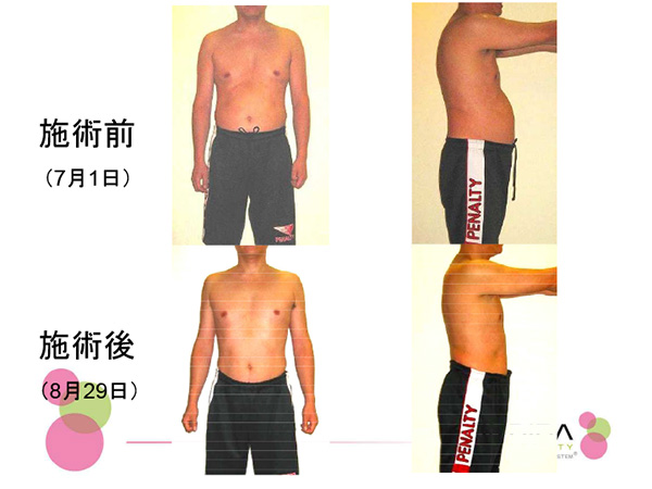 体型の変化ビフォーアフター(インディバ)