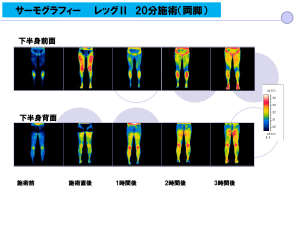 インディバ施術のビフォーアフター