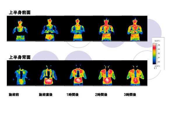 インディバ施術のビフォーアフター