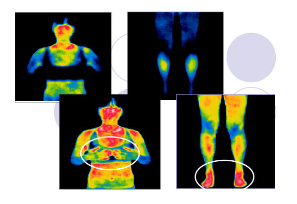 インディバ施術のビフォーアフター